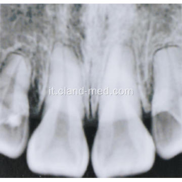 UNITÀ X-RAY DENTALE